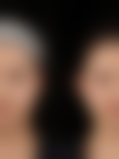 温州林琦医疗美容诊所林琦医生预约挂号指南