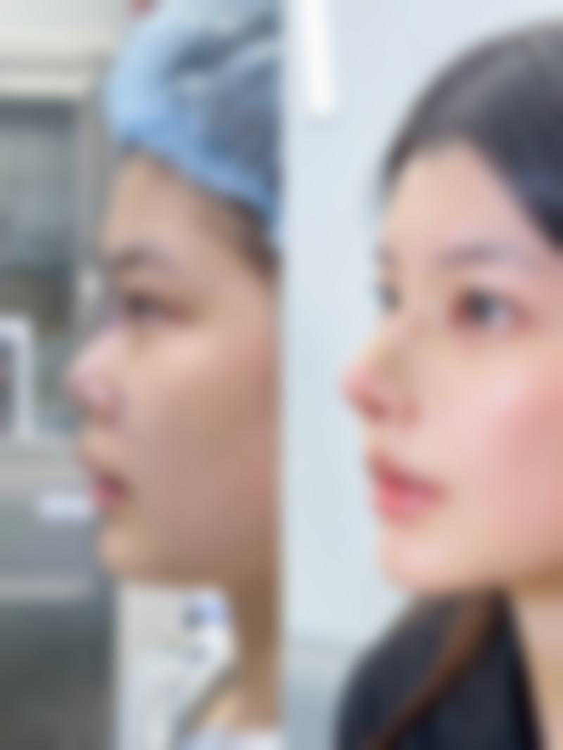 兰州爱美相伴医疗美容门诊部刘纯熙医生擅长项目