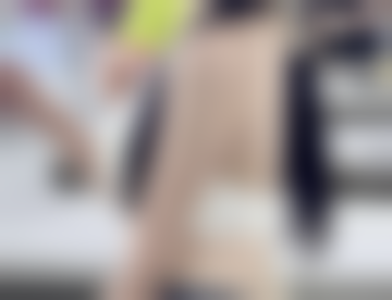 I'M整形医院Go,Duckho医生眼部整形技术怎么样？