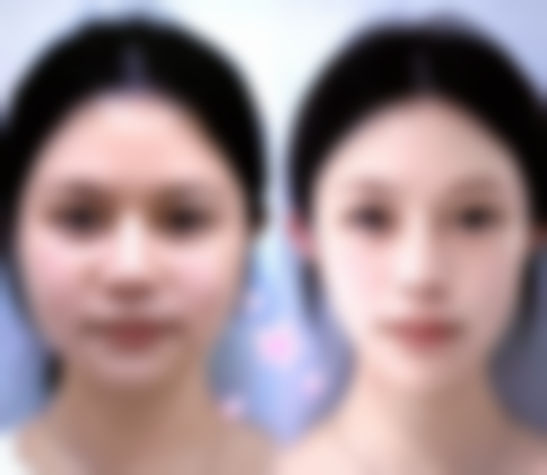 术后不同阶段对吃辣椒有什么要求？