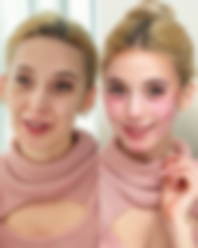 南京大麦植发医院（原科发源）沈晓海医生擅长项目