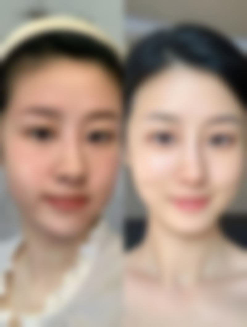 广州中山大学孙逸仙纪念医院孟强医生擅长项目