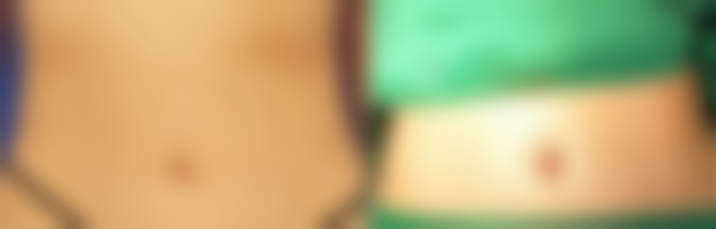 大连比华利医疗美容诊所怎么预约