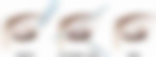 韩国MIGO整形外科正规吗？