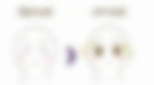 眼袋抽脂修复期的真实情况是怎样的？