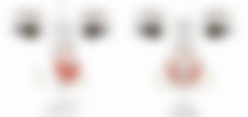 南京大麦植发医院（原科发源）沈晓海医生发际线调整技术怎么样？