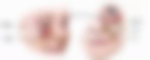 广州中山大学孙逸仙纪念医院孟强医生患者评价