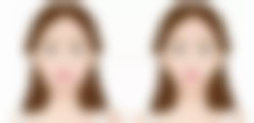 洛阳雅美嘉医疗美容门诊部石音医生擅长项目