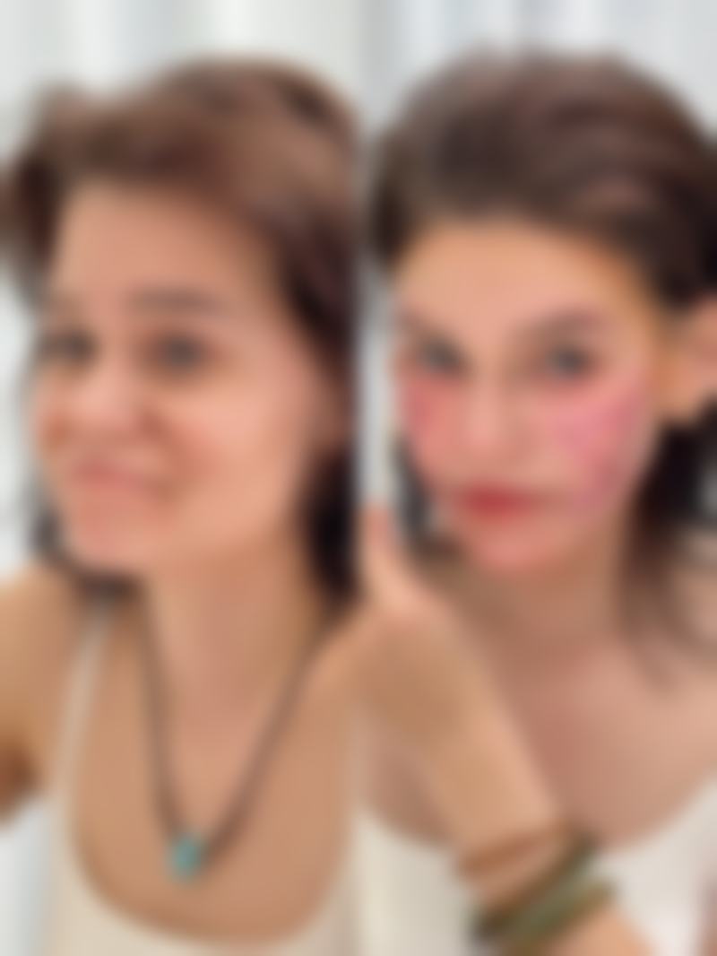 洛阳雅美嘉医疗美容门诊部石音医生患者评价