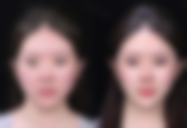 南京大麦植发医院（原科发源）沈晓海医生擅长项目