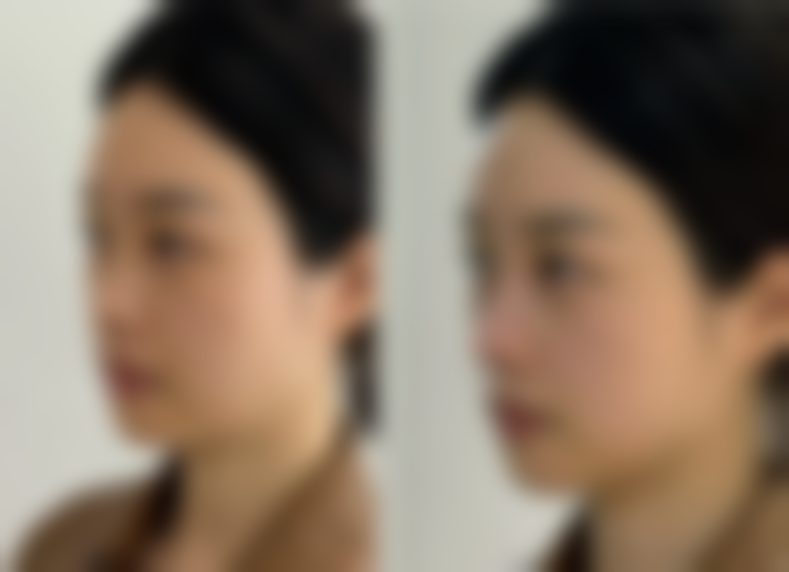 I'M整形医院Kim,Jaenam医生患者评价