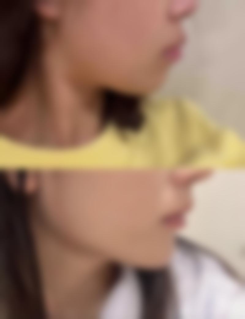 广州皇佳贝丽医疗美容门诊部马爱明医生擅长项目