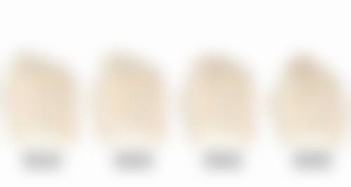 手术成效受哪些因素影响呢?