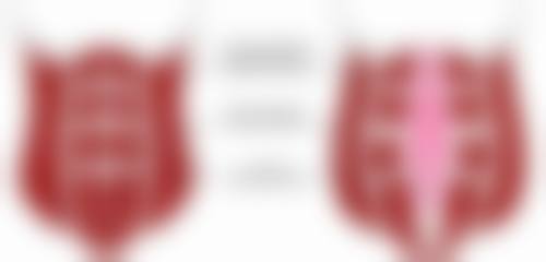 两人都是双眼皮会生出单眼皮吗?揭秘遗传与美丽的秘密!——生出单眼皮孩子的可能性及原因篇