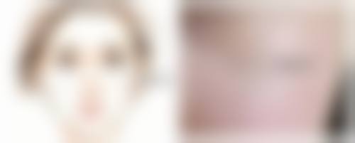 怎么抑制疤痕体质的疤痕疙瘩生长？这5个方法你必须知道！它们能让疤痕疙瘩不再肆意疯长吗？ 