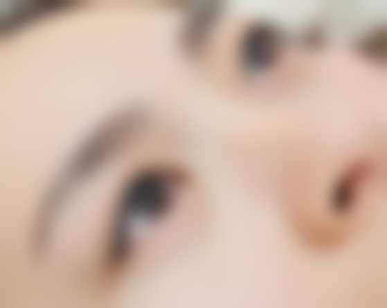 广州皇佳贝丽医疗美容门诊部雷义波医生患者评价