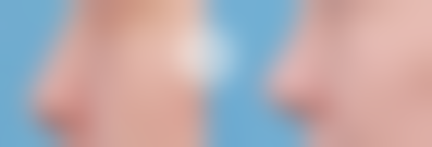 韩国大邱oblige整形外科怎么预约