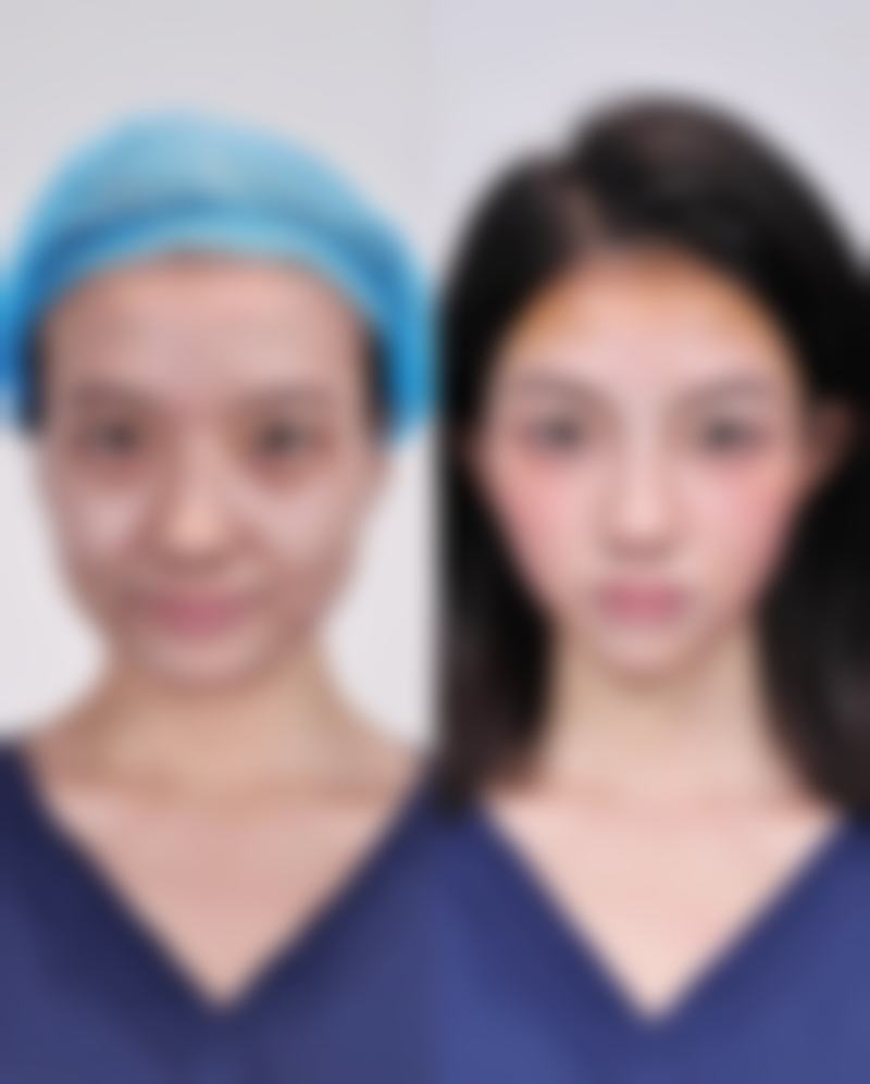 郑州米兰整形美容口碑评价怎么样?