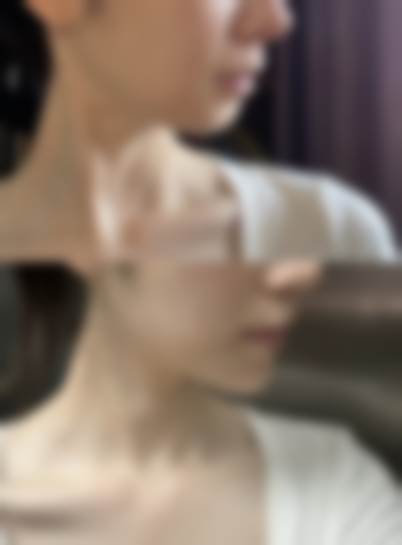 问题二：洋葱提取物类凝胶能治疗烫伤疤痕吗？