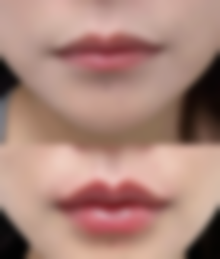 广州中山大学孙逸仙纪念医院张剑医生收费价格