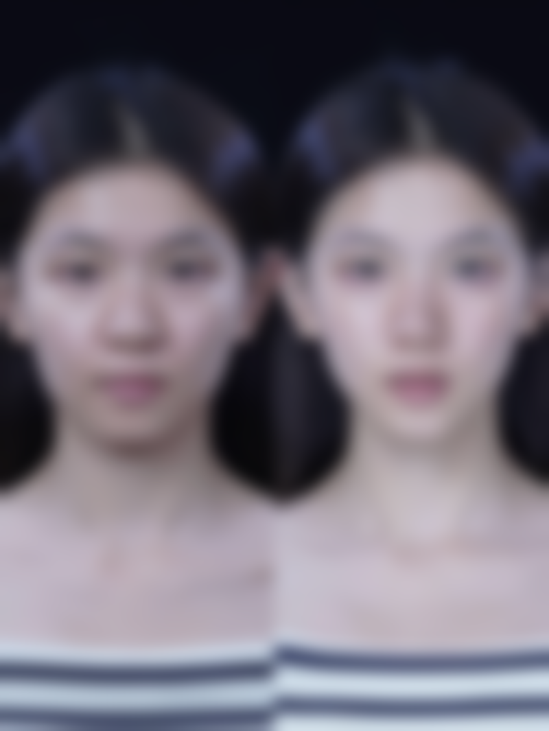 不同手术方式的维持时间有何不同？