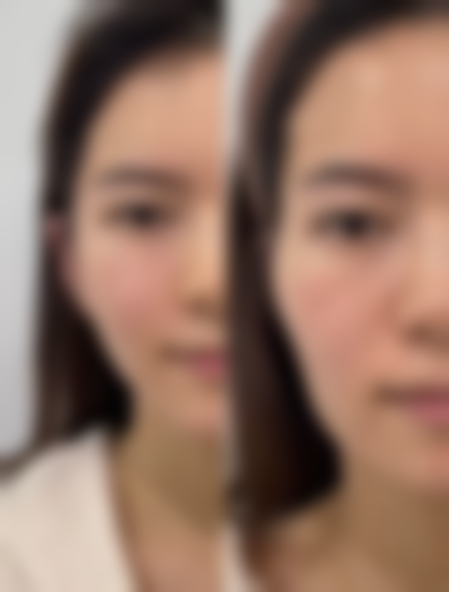 两人都是双眼皮会生出单眼皮吗?揭秘遗传与美丽的秘密!——眼皮遗传的其他特点篇