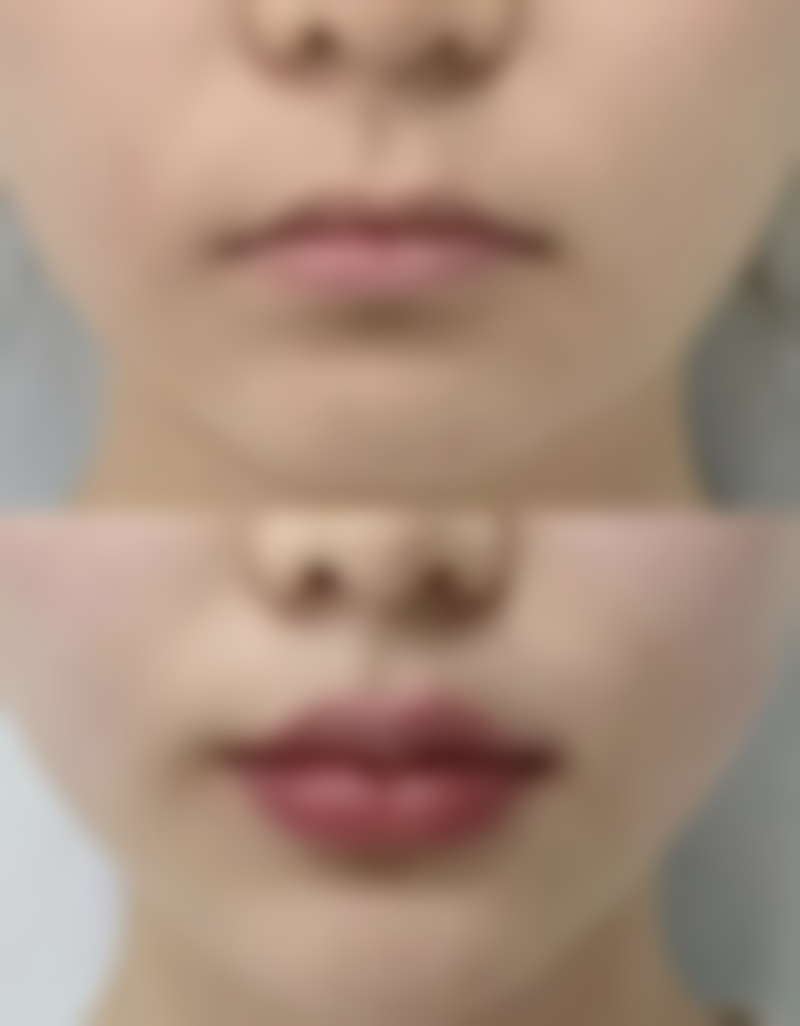 问题三：积雪苷霜软膏对烫伤疤痕有什么作用？