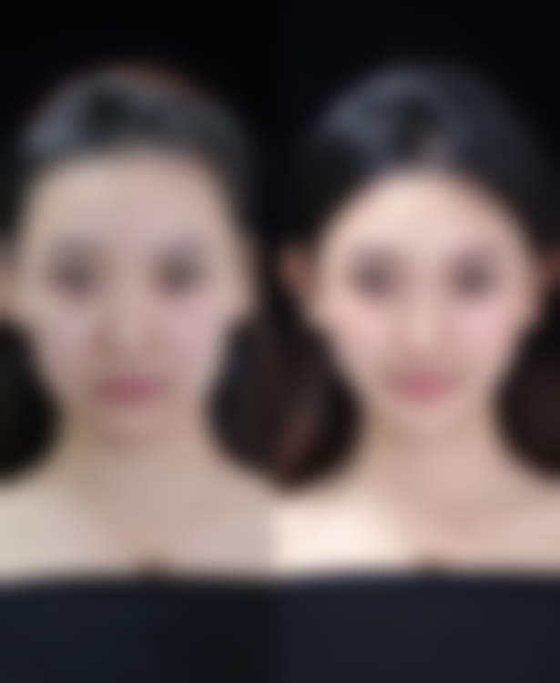 揭秘!四川成都美容整形医院私密科李挺医生——良好口碑值得信赖