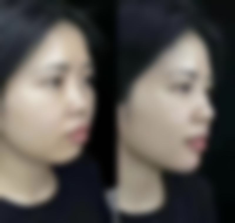 洛阳雅美嘉医疗美容门诊部石音医生患者评价