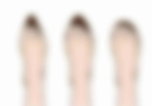 手术方法有哪些能实现双眼皮变单眼皮？