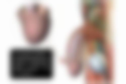 哪些人适合玻尿酸填充丰太阳穴呢？