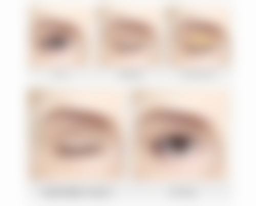 自体脂肪移植丰太阳穴是怎么回事？有什么特点？