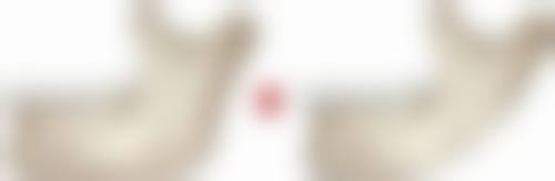 48岁女人可以做隆胸吗？揭秘年龄与美丽的真实关系！身体条件允许时其实是可行的！ 