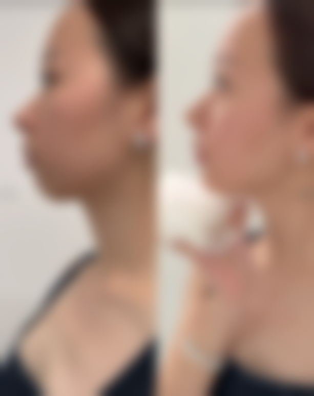 许昌融美整形医院口碑评价怎么样？