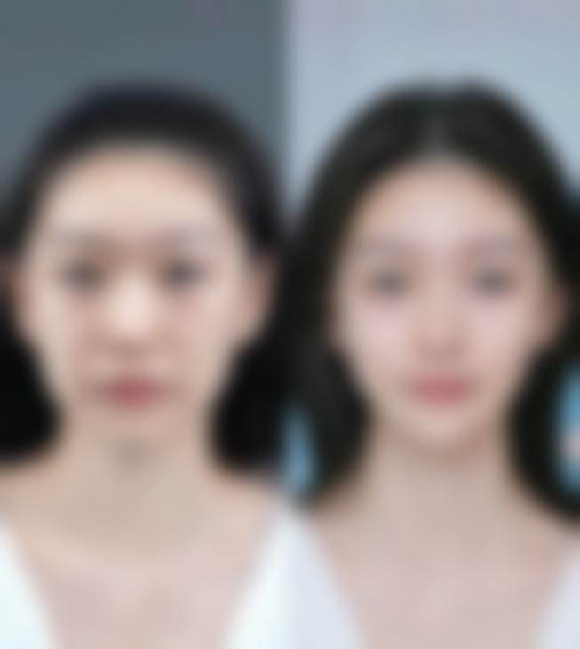 贵阳科珑整形医院口碑评价怎么样？