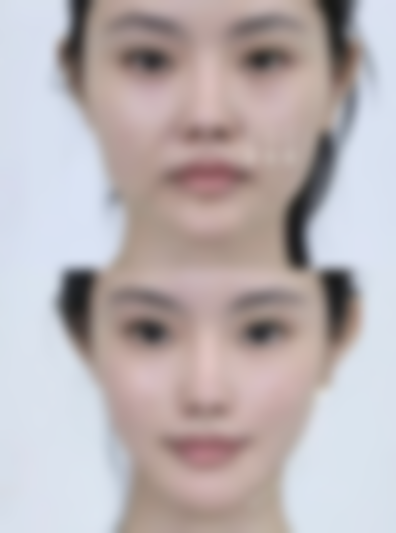 在术前需要做些什么准备呢？