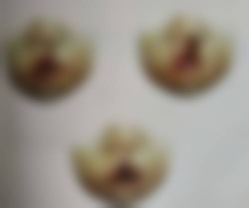 手术疤痕什么时候做激光好？专家为您解答最佳时机与效果！激光祛疤效果能维持多久？ 