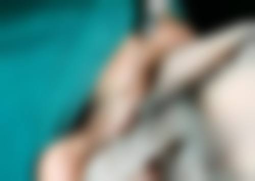 怎样才能快速变成双眼皮？揭秘医美专家推荐的5种有效方法！哪种最适合你呢？ 