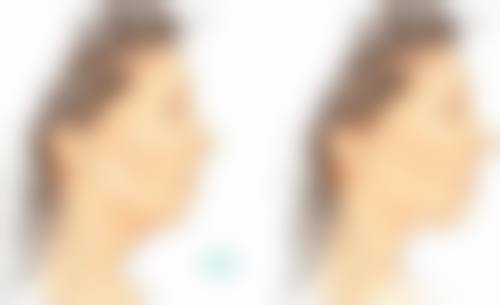 银川市刘耐温医学美容门诊部怎么预约