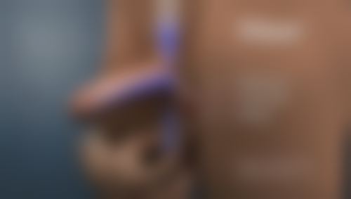 西安光知美整形美容门诊部怎么预约：