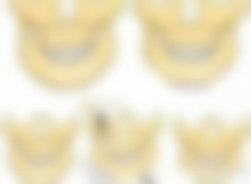 揭秘医美骨干医生推荐的手术恒久变成双眼皮的方法有哪些？埋线双眼皮是怎样的呢？