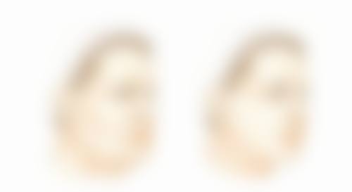 邢台伊美整形医院怎么预约: