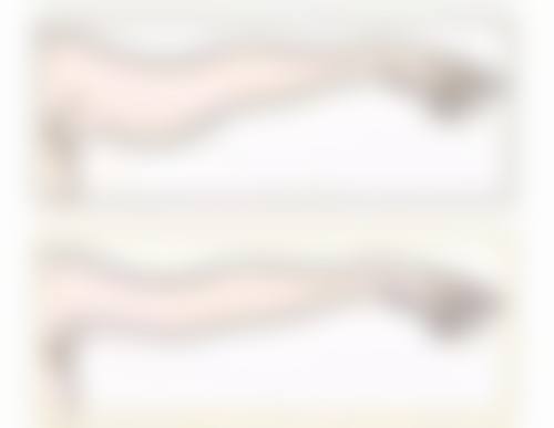 旧疤痕淡化比较有效的药膏：如何选择适合你的产品？看成分功效和适用肤质就对了！ 