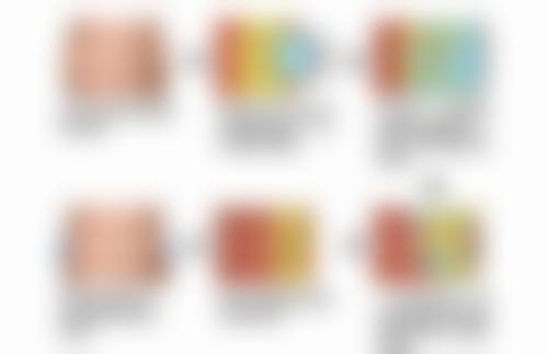 手术疤痕做激光治疗前需要注意些什么呢?