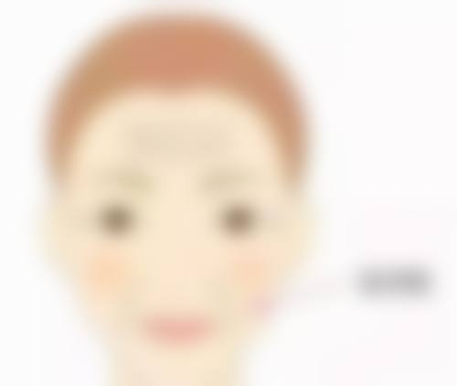 术后护理对埋线双眼皮维持时间有多关键?