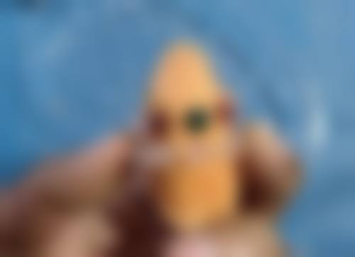 手术疤痕激光治疗后又有哪些注意事项呢?