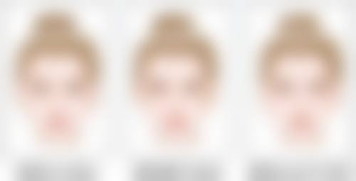 术后1个月后饮食能修复正常吗？