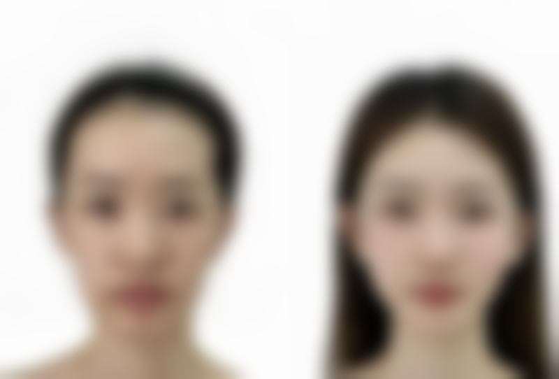 新乡医学校第一附属医院烧伤整形与医疗美容科正规吗?