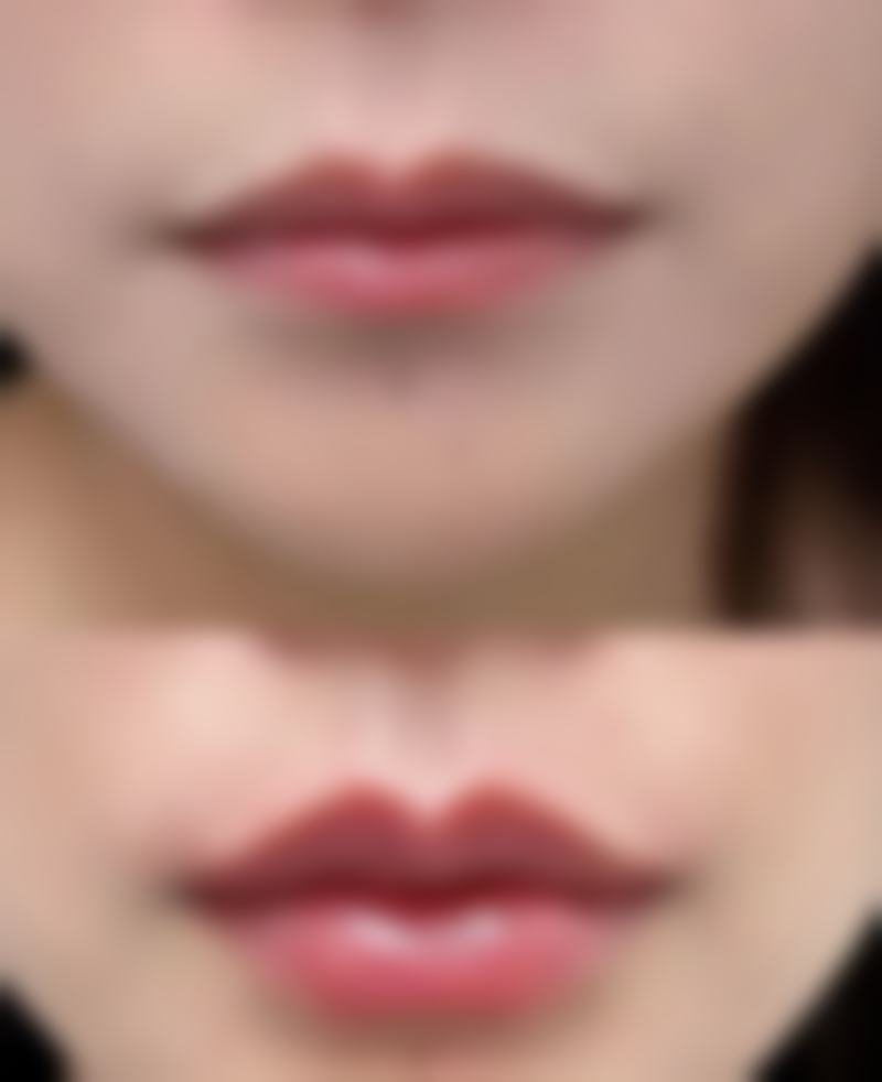 松滋叶美整形医院总结