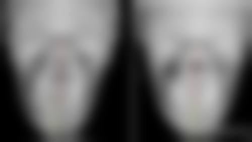 东莞华美医疗美容医院钟展芳医生预约挂号指南